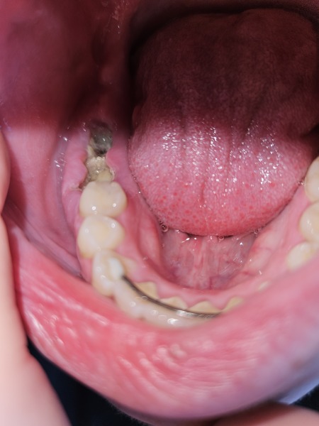 Any dentists around? Photo TMI !