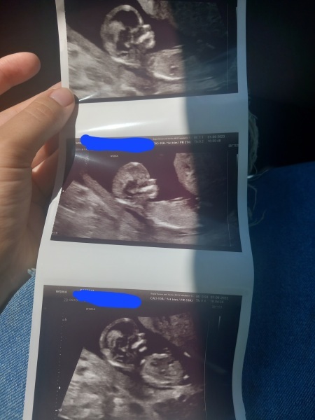 Predicting baby’s gender