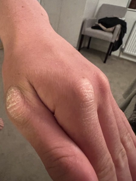 What are these patches on his hands?