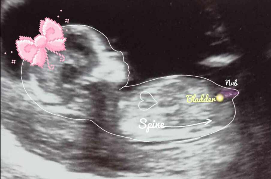 14 weeks scan. Gender guess please