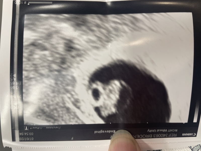 Trying to conceive over 40 part 4