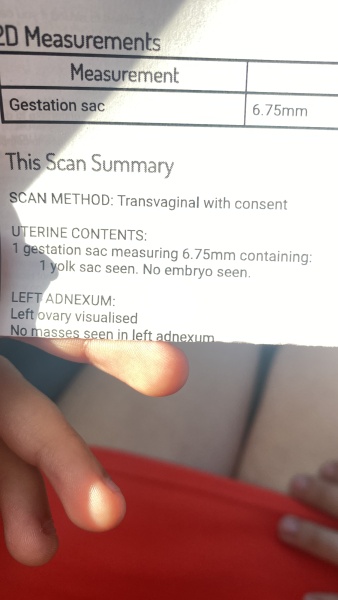Had a early scan now I’m scared 