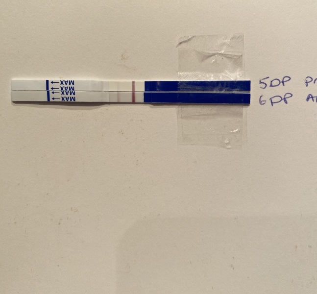 What IVF dose and how many eggs did you get?