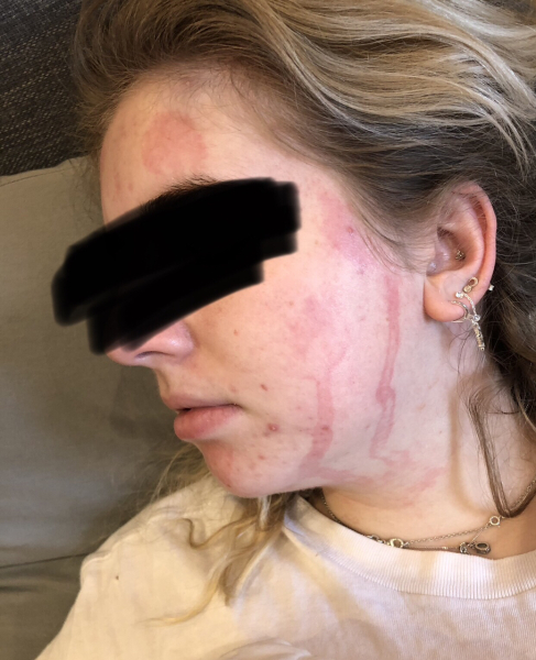 Coeliacs (and Others) Assemble!