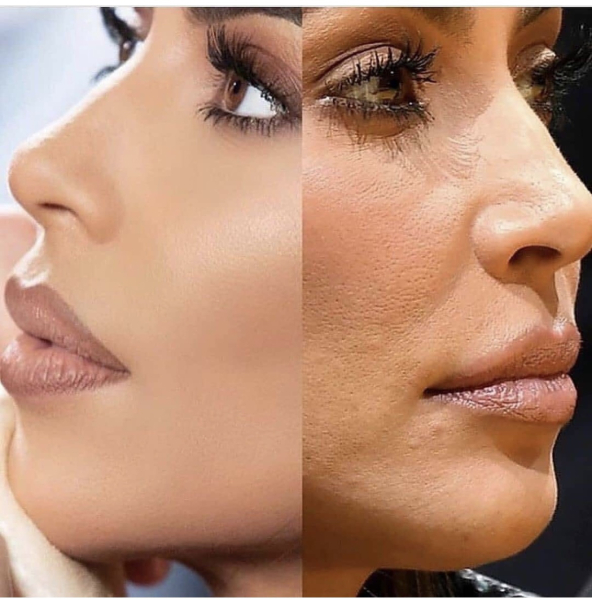 Have you ever seen a model with varicose veins or a skin condition like eczema or psoriasis?
