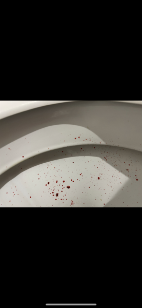 Heavy rectal bleeding and tummy pain - pics in comments (TMI)