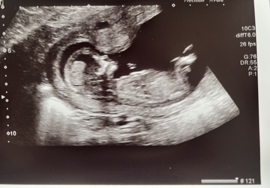 Due January Part 4! 🎉