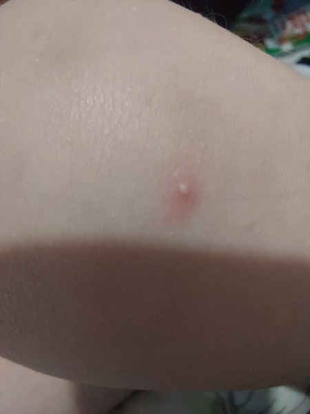 What are these spots?