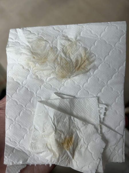 Implantation bleeding?