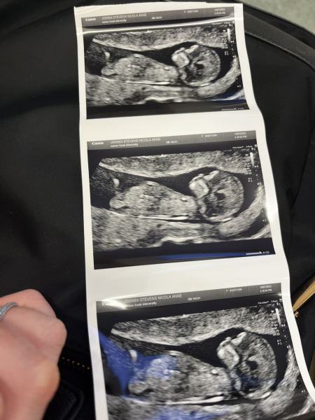 Pregnant after miscarriage - support thread NEW