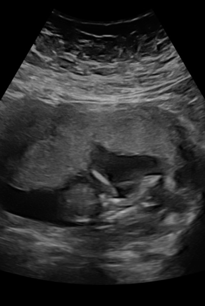 Boy or girl