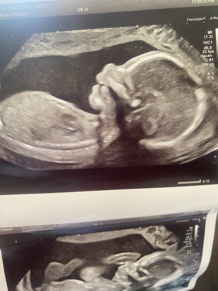 Boy or Girl? 