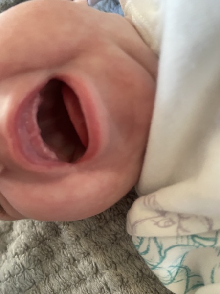 Am I going completely insane or is my 8 week old teething?!