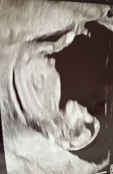 Due January Part 4! 🎉