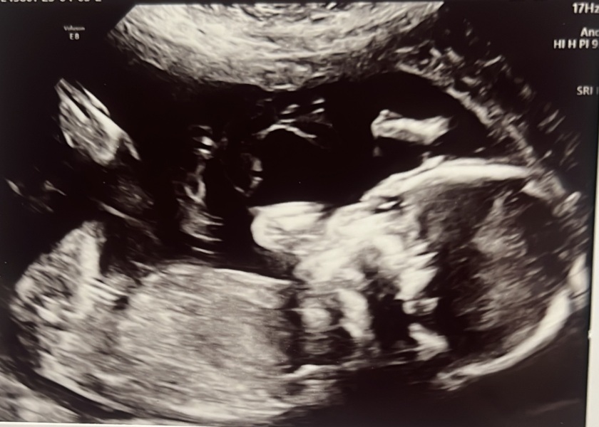 Boy or Girl?