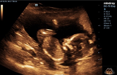 Boy or girl? 
