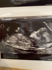 Due January 2024 🎉 PART 3