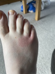 Should I be worried about this foot pain?