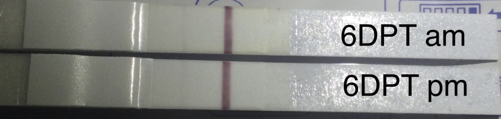 What IVF dose and how many eggs did you get?