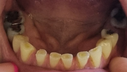 £12k for dental treatment?! 