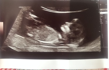Pls would you guess our gender!!! Too excited to contain myself!!