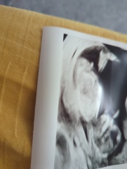 Boy or Girl