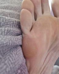 Disgusting feet! 