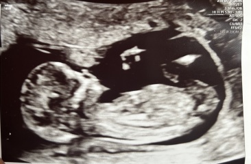 Any gender guesses? 12 week scan :)