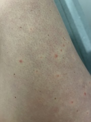 Rash- any ideas? 