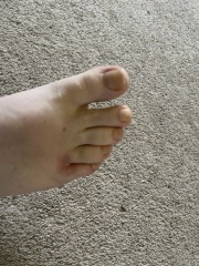 Should I be worried about this foot pain?
