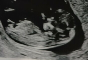 Boy or girl?