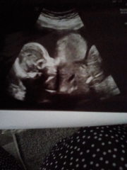 Can you tell gender from 20 week scan photo?