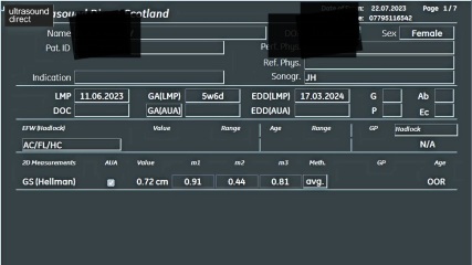 Private scan measurements please help me