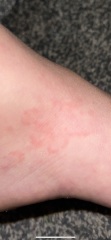Can anyone tell me what this is on my son please?