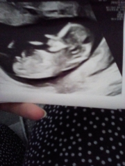 Can you tell gender from 20 week scan photo?