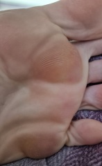 Disgusting feet! 