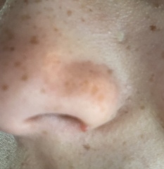 What is this on teen DD’s nose?
