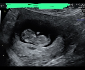 Boy or girl 