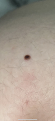 Does this look concerning? 