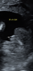 Wrong gender?