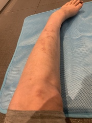 DD2 lost control, physically hurt us and has now left home forever