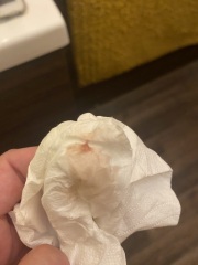 Another implantation bleed or period?! TW PHOTOS ATTACHED