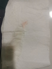 6DPO spotting after MMC in may *pic