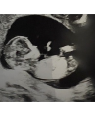 Gender Prediction - Nub Theory