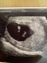 Due January 2024 🎉 PART 3