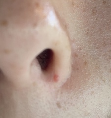 What is this on teen DD’s nose?