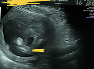 Any ideas on the gender ? 