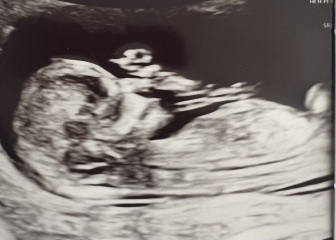 Boy or Girl?
