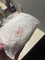 Implantation bleeding?!