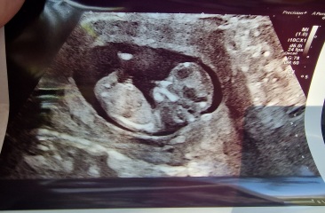 Boy or girl? 